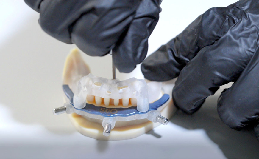 STRATASYS DENTAJET SERIES BUILDING MOMENTUM WITH DENTAL LABS GLOBALLY